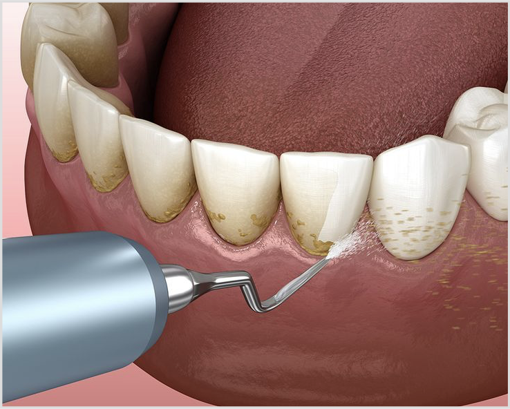 Preventive Dentistry